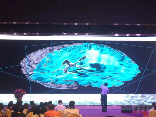 【醉木苑紅木】小葉紫檀的養(yǎng)生功效你知道多少？